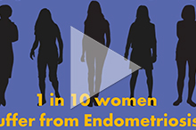 Endometriosis Stats